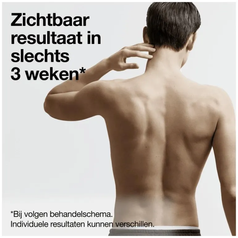 Braun IPL Silk-expert Pro 5 PL5145