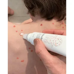 donttellmum Waterpokken Behandeling 50 ML