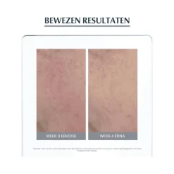 Eucerin AntiREDNESS Corrigerende Crème 50 ML