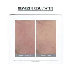 Eucerin AntiREDNESS Kalmerende Crème 50 ML