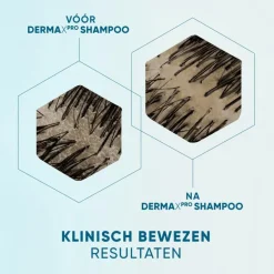 Head & Shoulders Derma X Pro Hydrateert Shampoo Anti-roos 250 ml