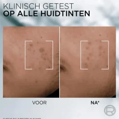 L'Oreal Men Expert Derma Control Serum 30ML