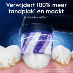 Oral-B iO Radiant White Opzetborstels Zwart 4 Stuks
