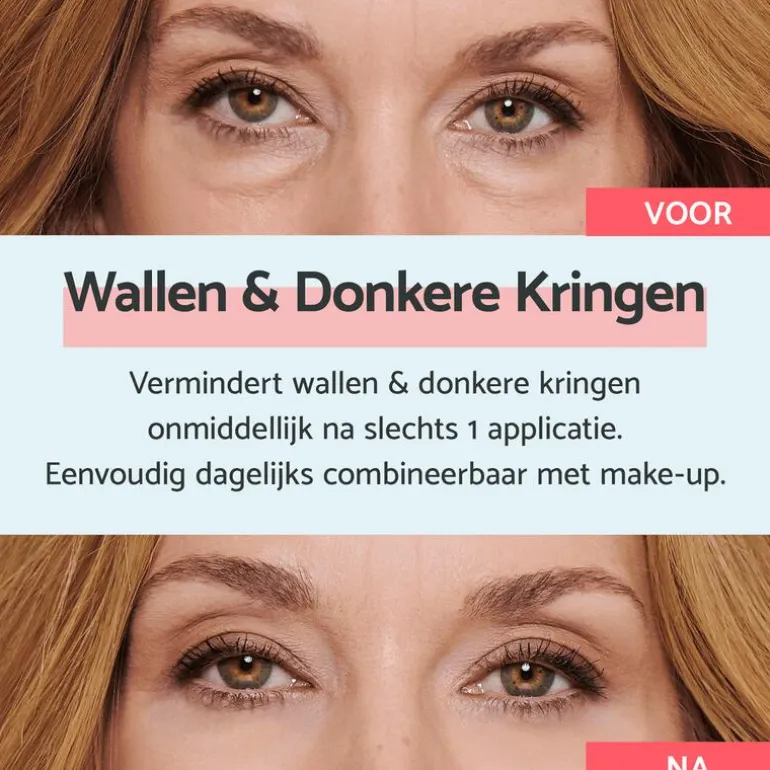 Remescar Wallen & Donkere Kringen Crème 8 ML
