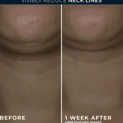 RoC Derm Correxion Contour Cream 50 ML