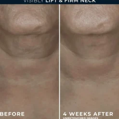 RoC Derm Correxion Contour Cream 50 ML