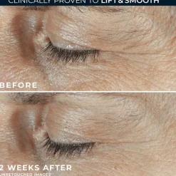 RoC Derm Correxion Dual Eye 20 ML