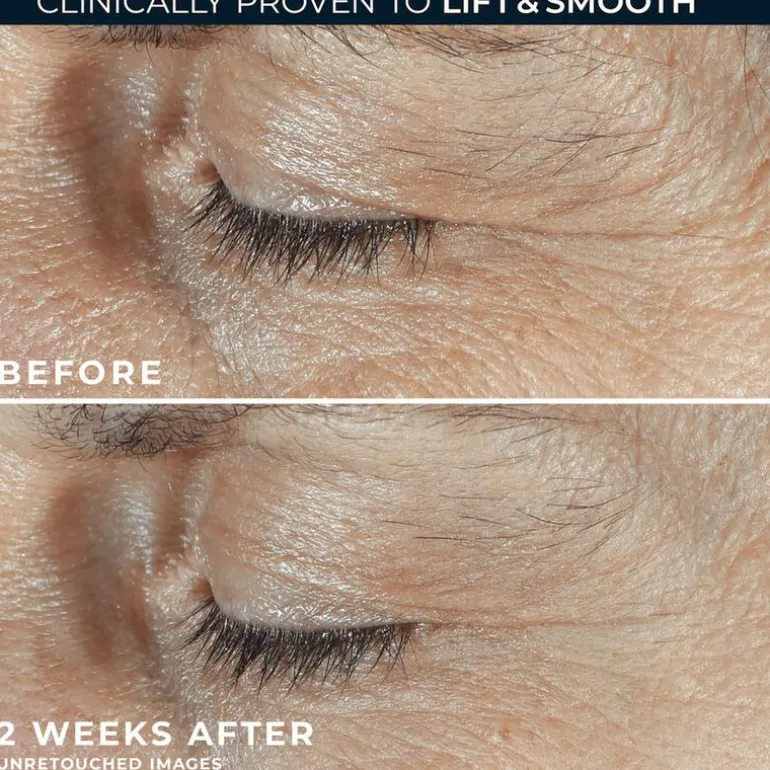 RoC Derm Correxion Dual Eye 20 ML