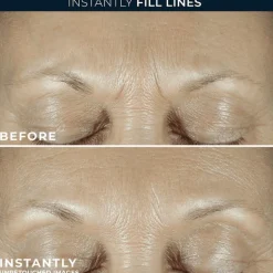 RoC Derm Correxion Fill + Treat Serum 15 ML