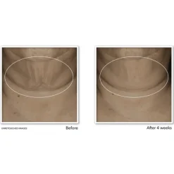 RoC Derm Correxion Firming Serum Stick