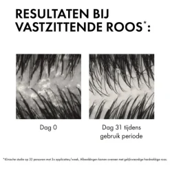 Vichy Dercos Anti-Roos DS Shampoo NH/VH Navulling 390 ML