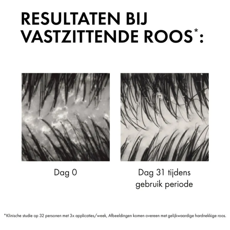 Vichy Dercos Anti-Roos DS Shampoo NH/VH Navulling 390 ML