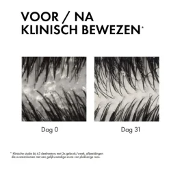 Vichy Dercos Anti-Roos-2-In-1-Shampoo + Conditioner 200 ML